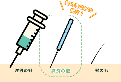 「鍼灸は痛いの？」と不安な方へ