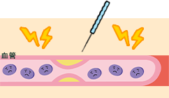 ツボの刺激・筋肉のコリや緊張に刺激が入る